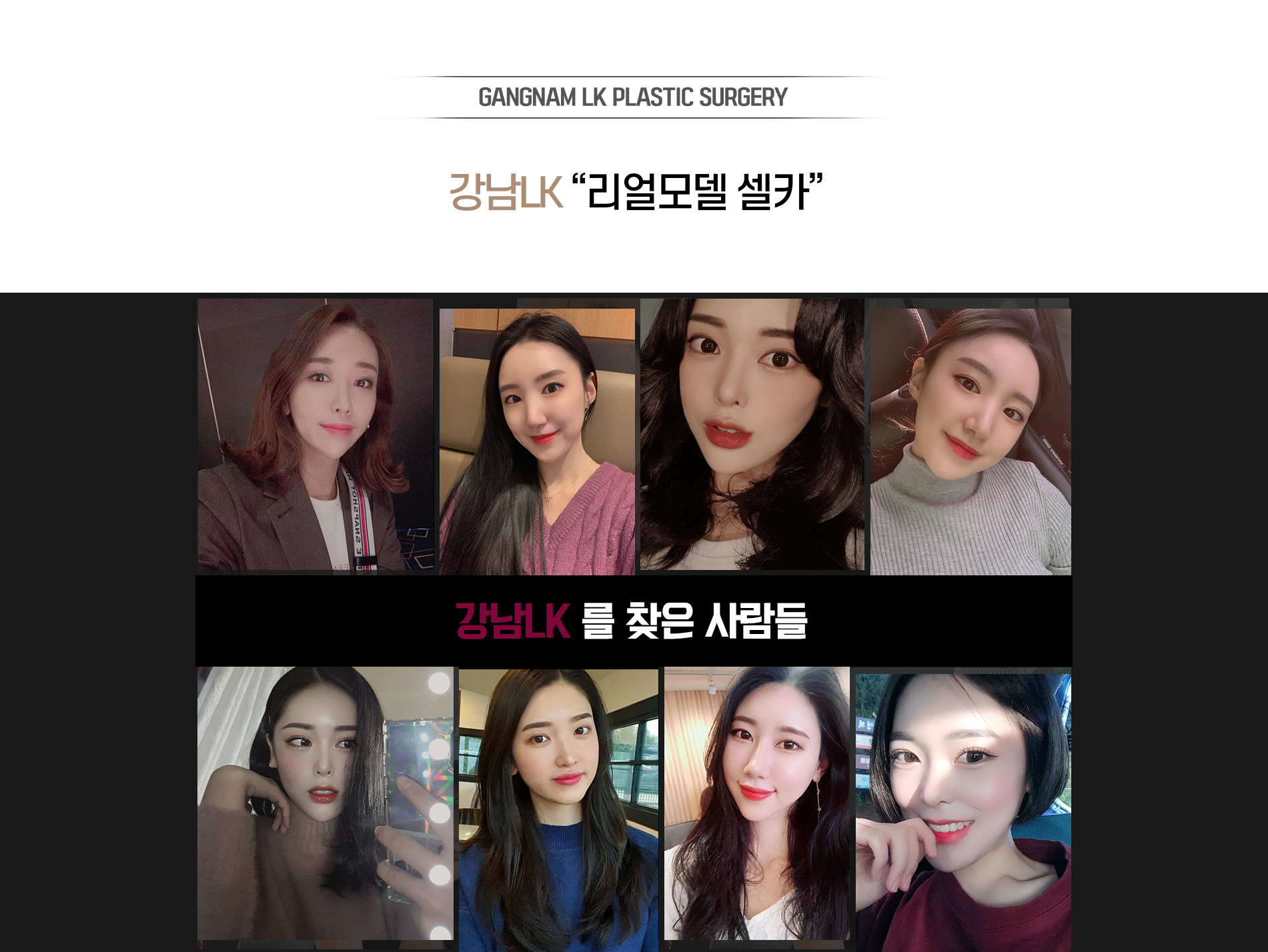 미니리프팅